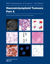 WHO Classification of Tumours: Haematolymphoid Tumours 