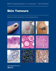 WHO Classification of Tumours 