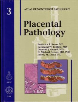 Placental Pathology 