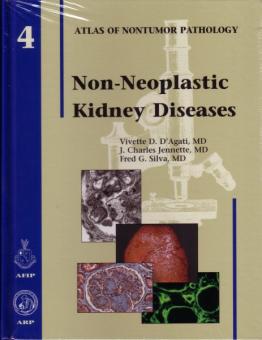Non-Neoplastic Kidney Diseases 