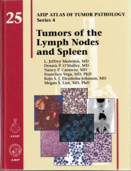 Tumors of the Lymph Nodes and Spleen 