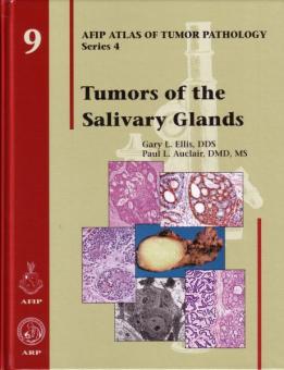 Tumors of the Salivary Glands 