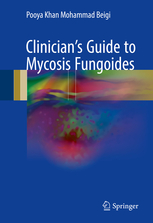 Clinician's Guide to Mycosis Fungoides 