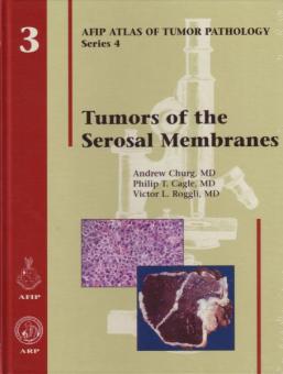 Tumors of the Serosal Membranes 