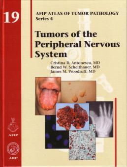 Tumors of the Peripheral Nervous System Hardcover