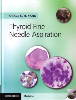 Thyroid Fine Needle Aspiration 