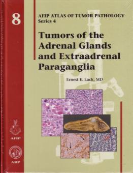 Tumors of the Adrenal Glands and Extraadrenal Paraganglia 