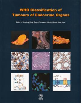 WHO Classification of Tumours of Endocrine Organs 