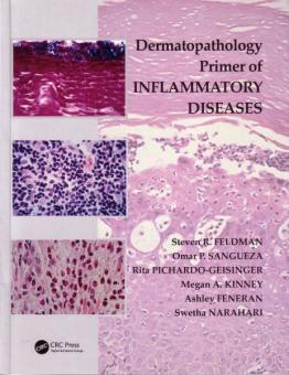 Dermatopathology Primer of Inflammatory Diseases 