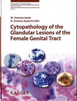 Cytopathology of the Glandular Lesions of the Female Genital Tract 