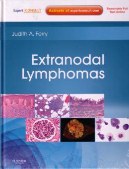 Extranodal Lymphomas 