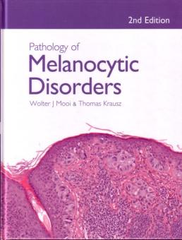 Pathology of Melanocytic Disorders 