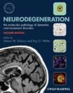 Neurodegeneration 