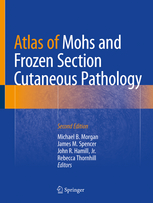 Atlas of Mohs and Frozen Section Cutaneous Pathology 