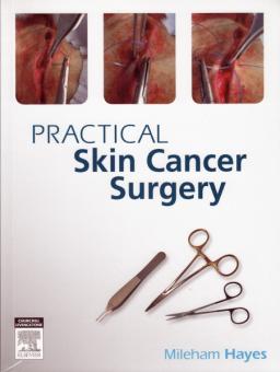 Practical Skin Cancer Surgery 