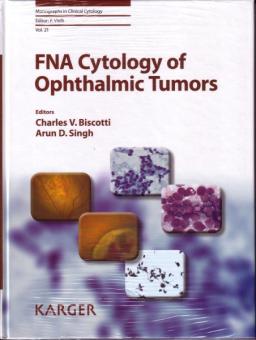 FNA Cytology of Ophthalmic Tumors 