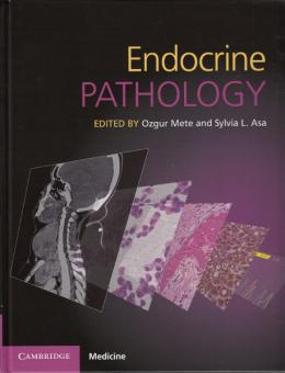 Endocrine Pathology 