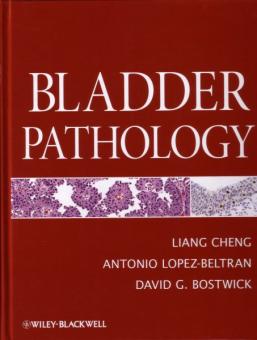 Bladder Pathology 