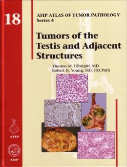 Tumors of the Testis and Adjacent Structures 