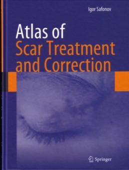 Atlas of Scar Treatment and Correction 