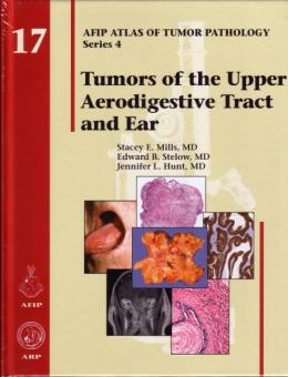 Tumors of the Upper Aerodigestive Tract and Ear 