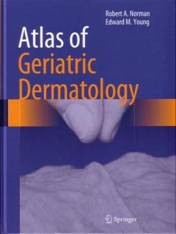 Atlas of Geriatric Dermatology 