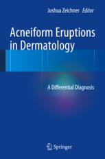 Acneiform Eruptions in Dermatology 