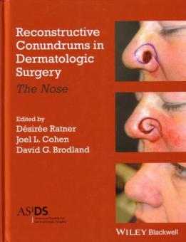 Reconstructive Conundrums in Dermatology 
