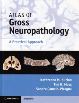 Atlas of Gross Neuropathology 