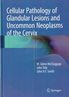 Cellular Pathology of Glandular Lesions and Uncommon Neoplasms of the Cervix 