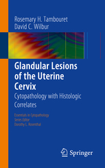 Glandular Lesions of the Uterine Cervix 