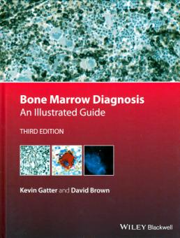 Bone Marrow Diagnosis 