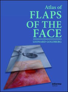 Atlas of Flaps of the Face 