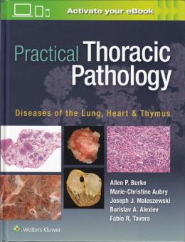 Practical Thoracic Pathology 