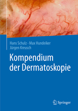 Kompendium der Dermatoskopie 