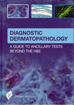 Diagnostic Dermatopathology 