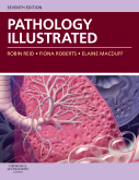 Pathology Illustrated 