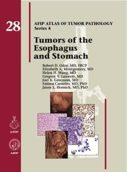 Tumors of the Esophagus and Stomach 