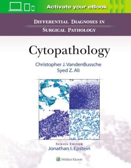 Differential Diagnosis in Cytopathology 