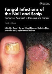 Fungal Infections of the Nail and Scalp 