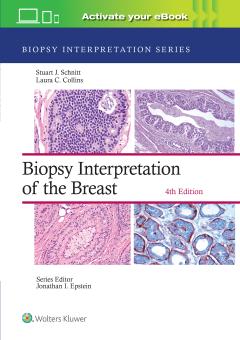 Biopsy Interpretation Series 