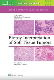 Biopsy Interpretation of Soft Tissue Tumors 