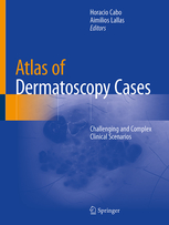 Atlas of Dermatoscopy Cases 