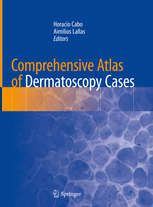 Comprehensive Atlas of Dermatoscopy Cases 