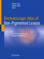 Dermatoscopic Atlas of Non-Pigmented Lesions 
