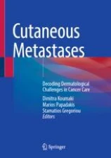 Cutaneous Metastases 
