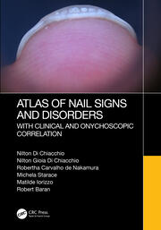 Atlas of Nail Signs and Disorders 