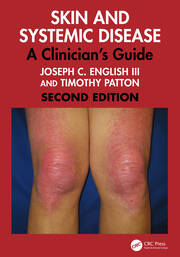 Skin and Systemic Disease 