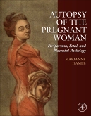 Autopsy of the Pregnant Woman 