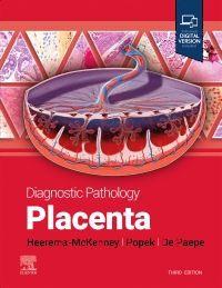 Diagnostic Pathology: Placenta 